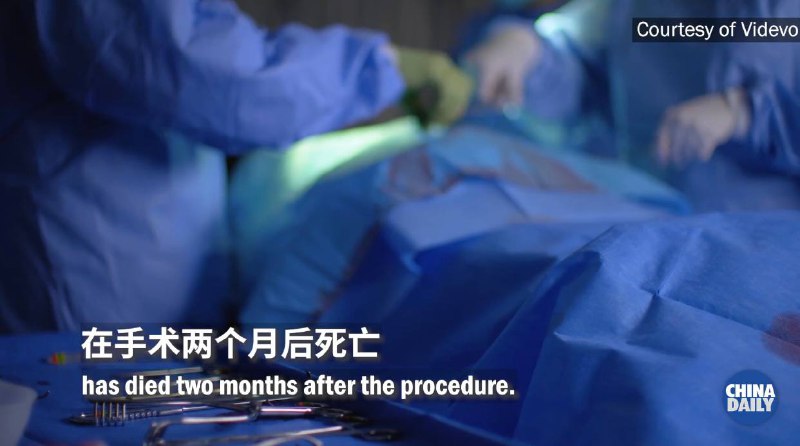 全球首位猪心脏移植病人在手术后两个月死亡